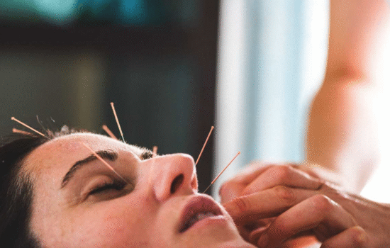 Acupuncture for Modern Life — Tiny Needles, Big Healing Power